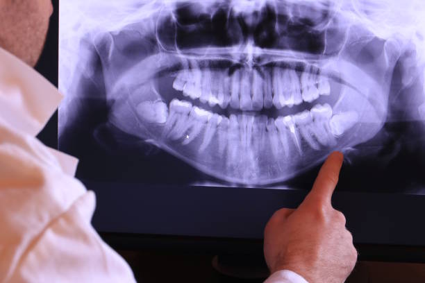 Best Emergency Root Canal Therapy in Breckenridge, MN