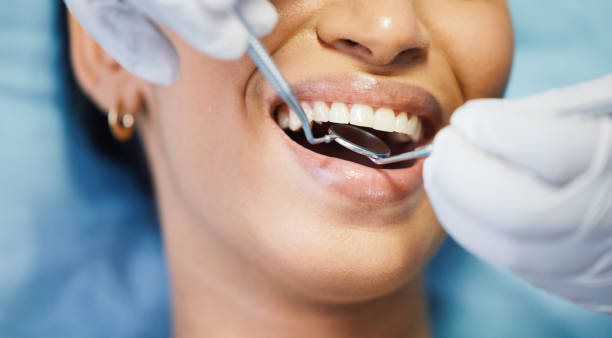 Best Emergency Cosmetic Dentistry (e.g., broken veneers) in Breckenridge, MN